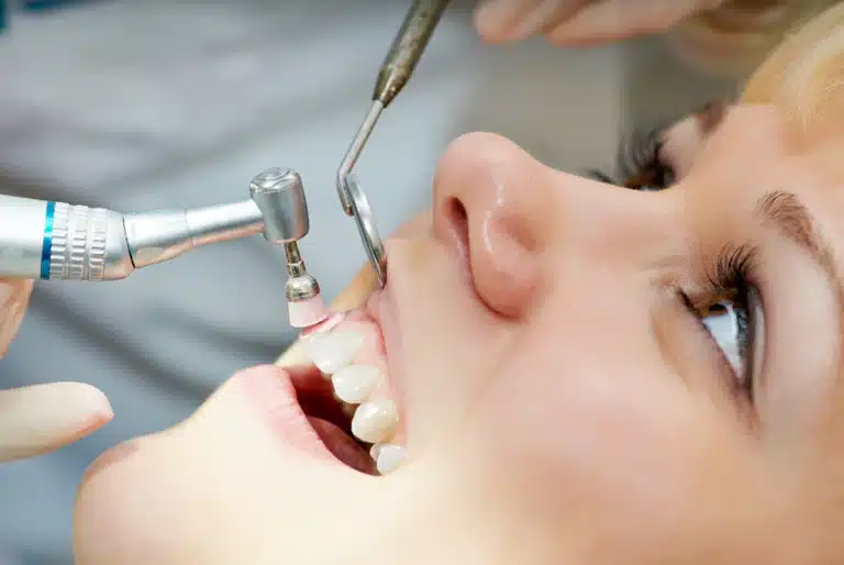 Profilaxis es un procedimiento para mantener los dientes sanos