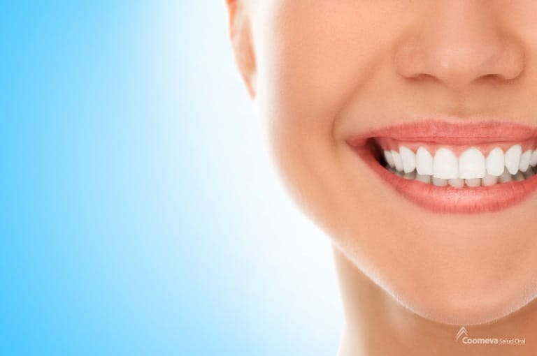 Blanqueamiento dental un tratamiento para una sonrisa radiante