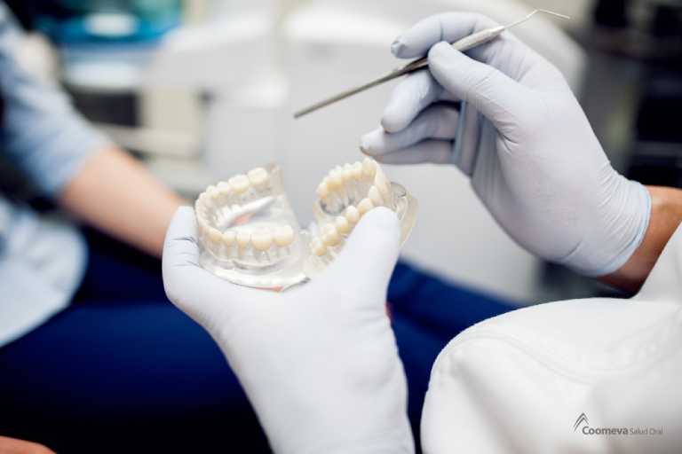 Tipos de dentadura postiza a considerar